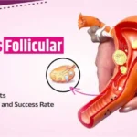 Understanding Follicular Study