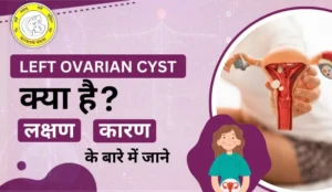 Left Ovarian Cyst in Hindi लेफ्ट ओवेरियन सिस्ट जानें कारण और इलाज