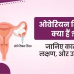Ovarian Cyst in Hindi ओवेरियन सिस्ट क्या है लक्षण एवं उपचार
