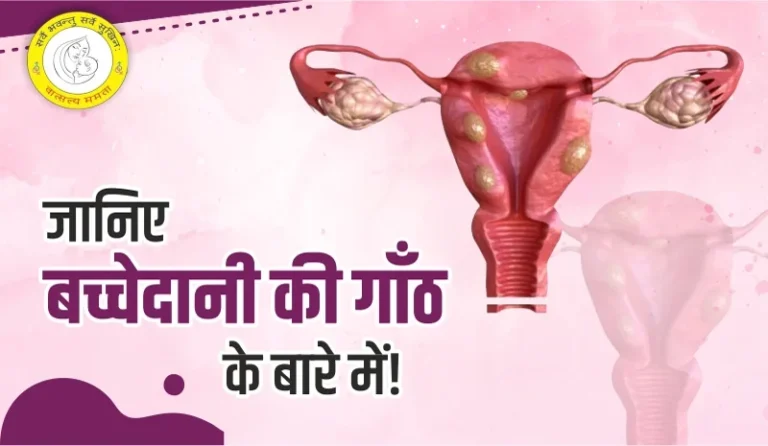 Bachedani Me Ganth बच्चेदानी में गांठ के कारण, लक्षण और इलाज की पूरी जानकारी
